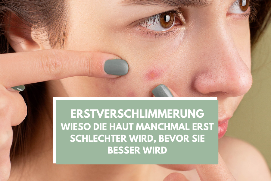 Blog-KBH-Preview-20 Erstverschlimmerung – Wieso die Haut manchmal erst schlechter wird, bevor sie besser wird
