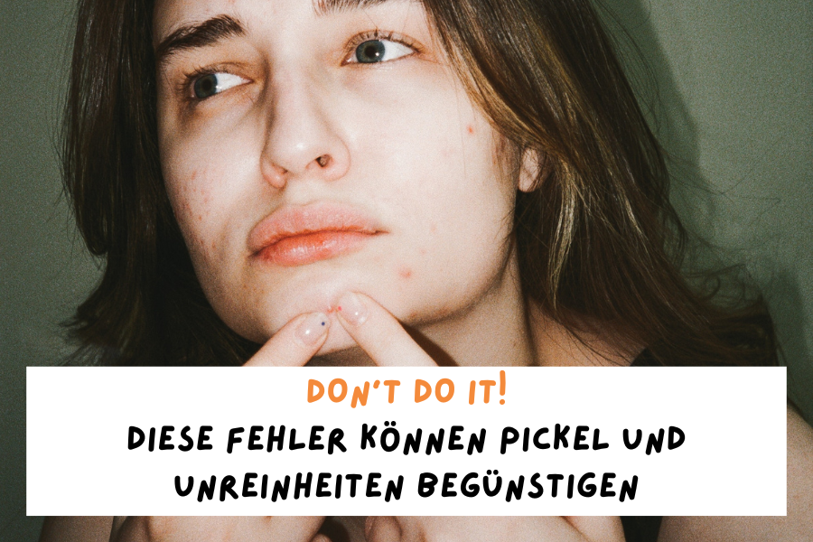 Don’t do it! – Diese Fehler können Pickel und Unreinheiten begünstigen