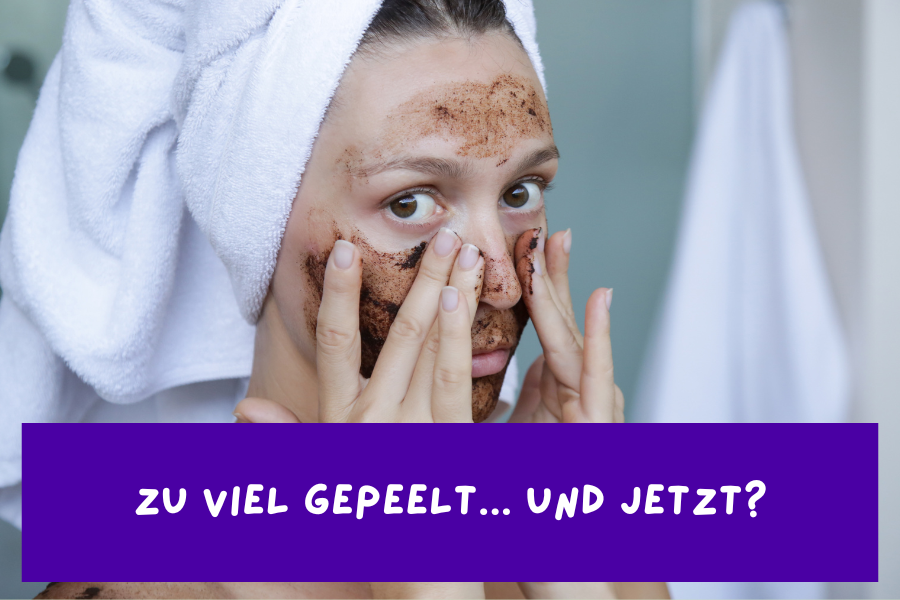 Blog-KBH-Preview-6RfBF9YaS0MEM2 Zu viel gepeelt – Und jetzt?