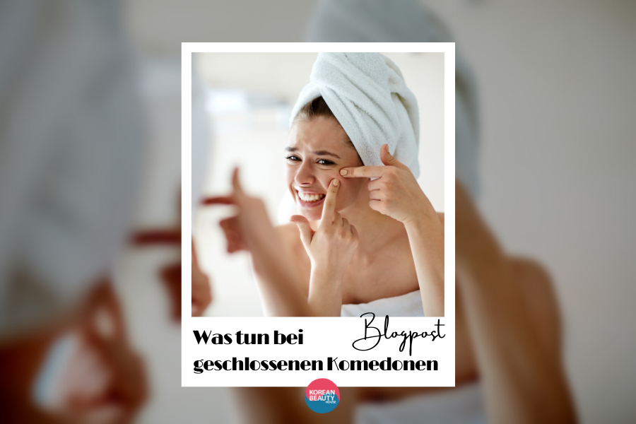 Kopie-von-Fact-Friday-Home-Spa-Routines-2 Wie du geschlossene Komedonen verhinderst und deine Hauttextur dadurch verbesserst