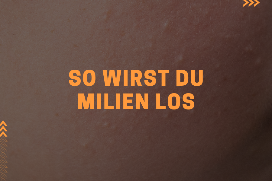 So wirst du Milien los