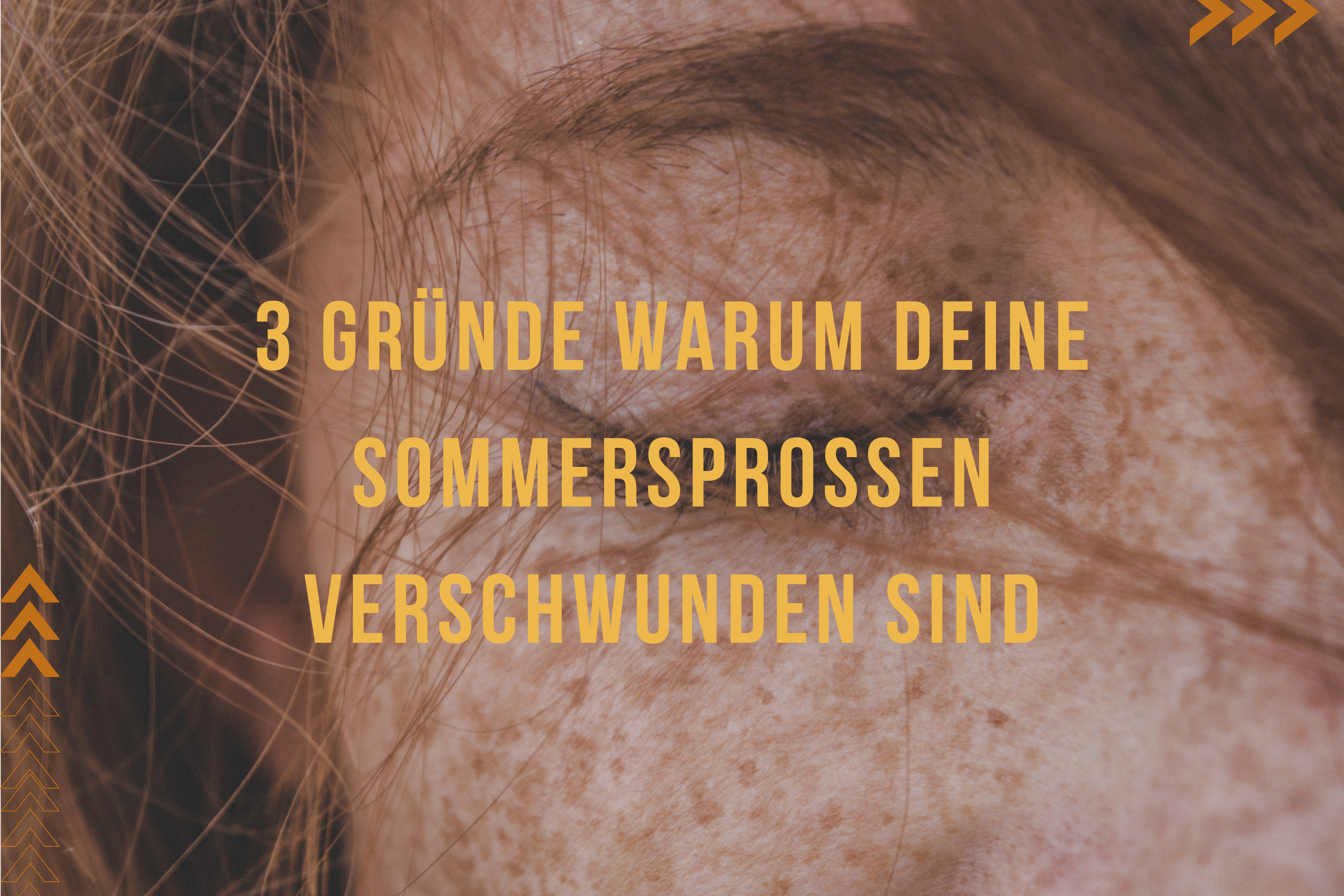 3 Gründe warum deine Sommersprossen verschwunden sind